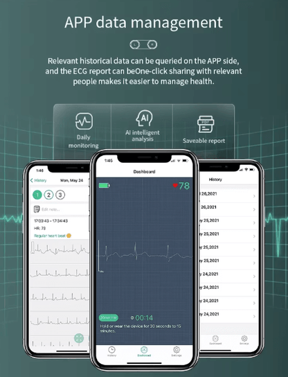 Wearable ECG Monitor/EKG Monitor - 24hr Holter with AI Analysis