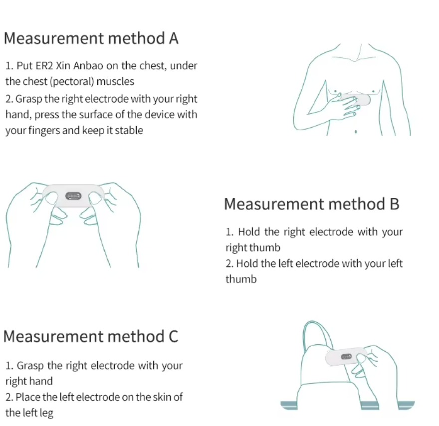 Wearable ECG Monitor/EKG Monitor - 24hr Holter with AI Analysis